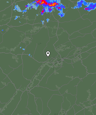 Radar