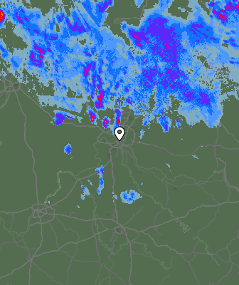 Radar
