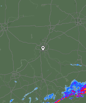 Radar