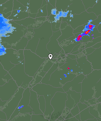 Radar