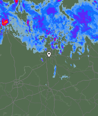 Radar