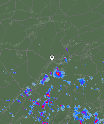 Radar