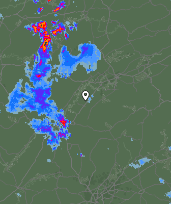 Radar