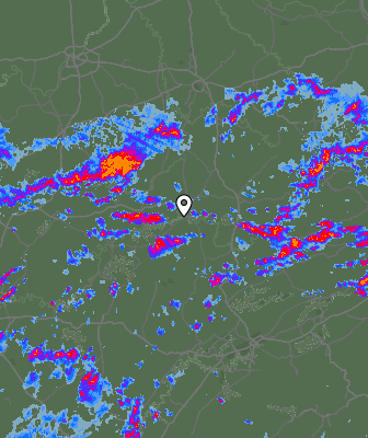 Radar