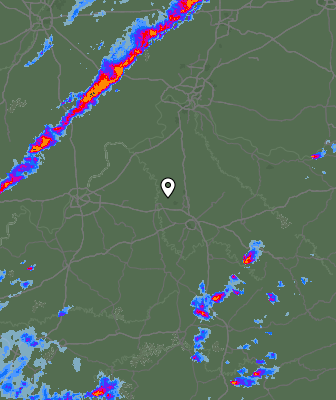 Radar