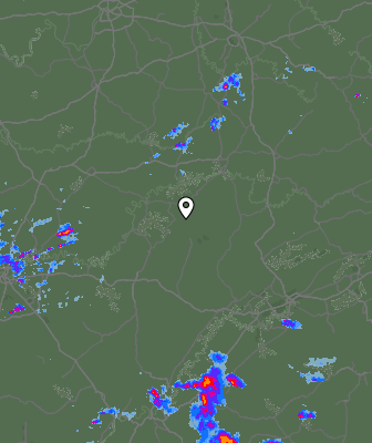 Radar