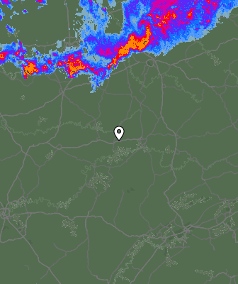 Radar