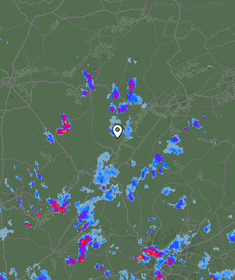 Radar