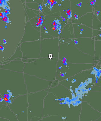 Radar