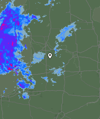 Radar