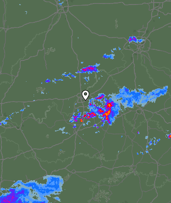 Radar