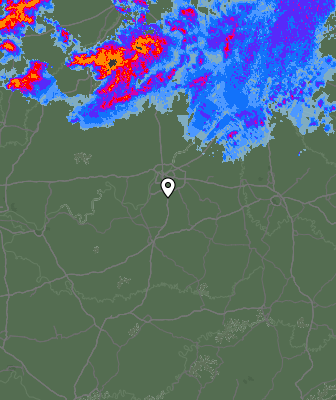 Radar