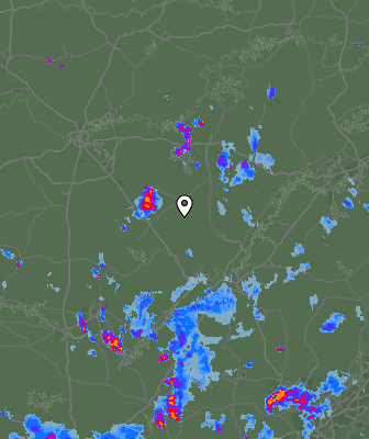 Radar