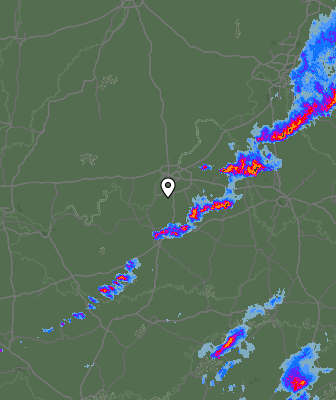 Radar