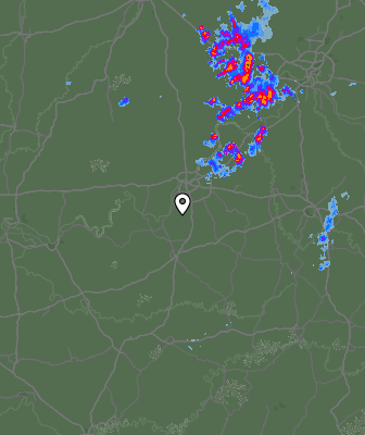 Radar