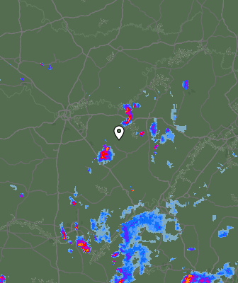 Radar