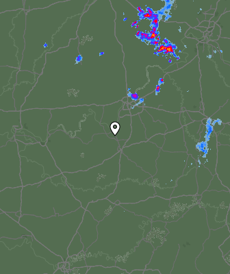 Radar
