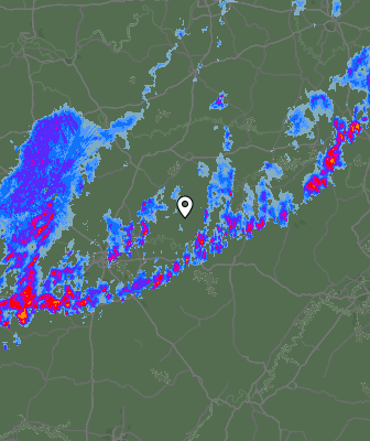 Radar