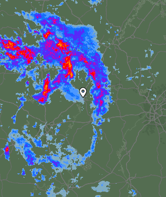 Radar