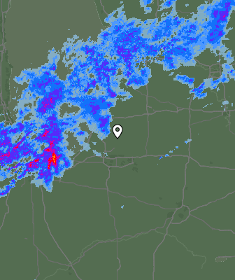 Radar