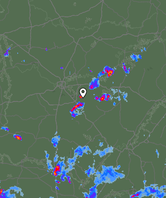 Radar