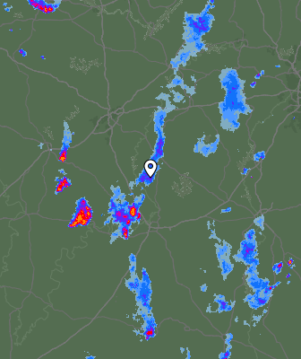 Radar
