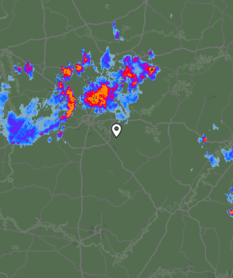 Radar