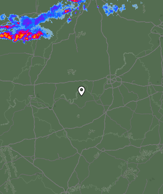 Radar