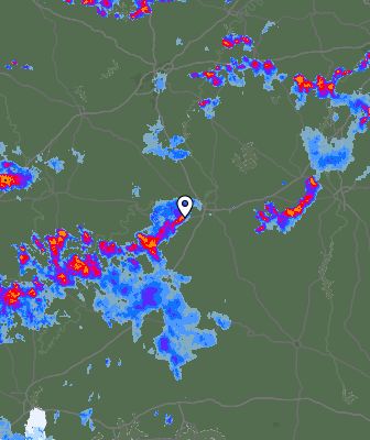 Radar
