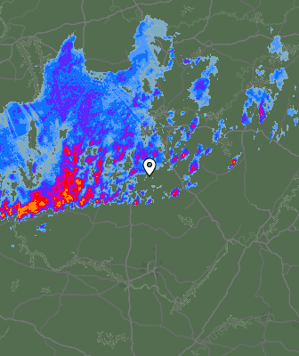 Radar