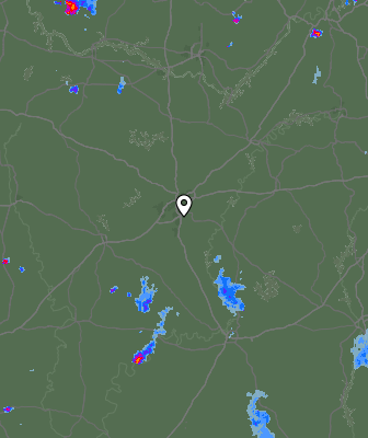 Radar