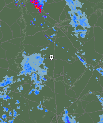 Radar