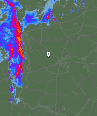 Radar
