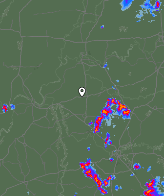 Radar