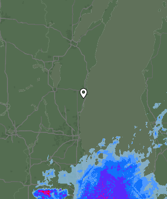 Radar