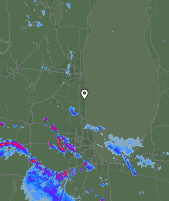 Radar