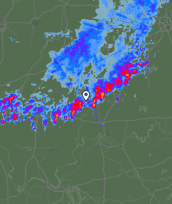 Radar