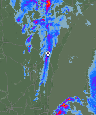 Radar