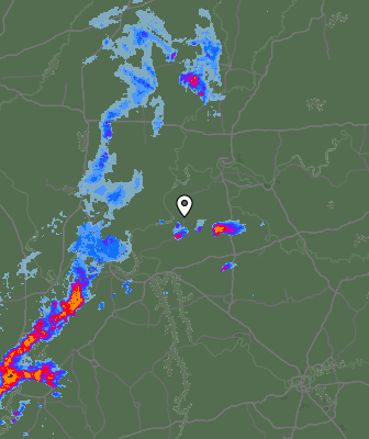 Radar