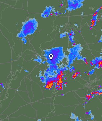 Radar