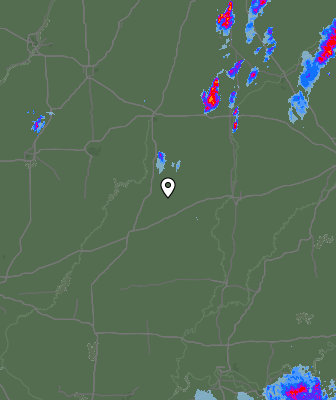 Radar