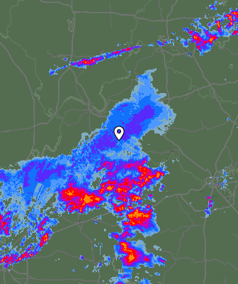 Radar