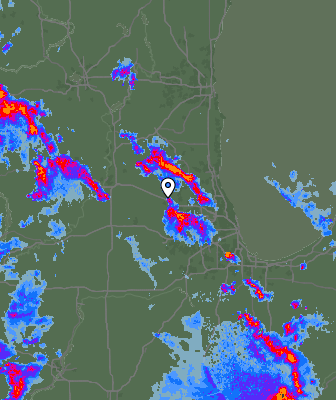 Radar