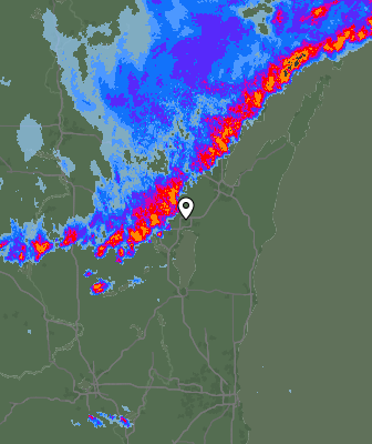 Radar