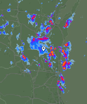 Radar