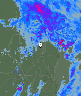 Radar