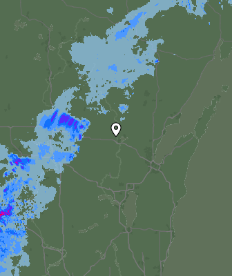 Radar