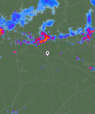 Radar