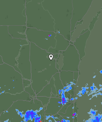 Radar