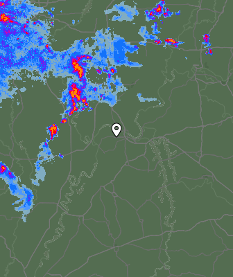 Radar